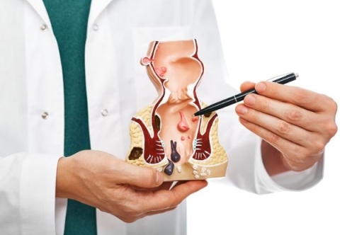 Bệnh trĩ có cần phẫu thuật không?